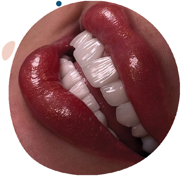 https://drhusseinmassri.com/wp-content/uploads/2025/09/smile-640x585-1.png