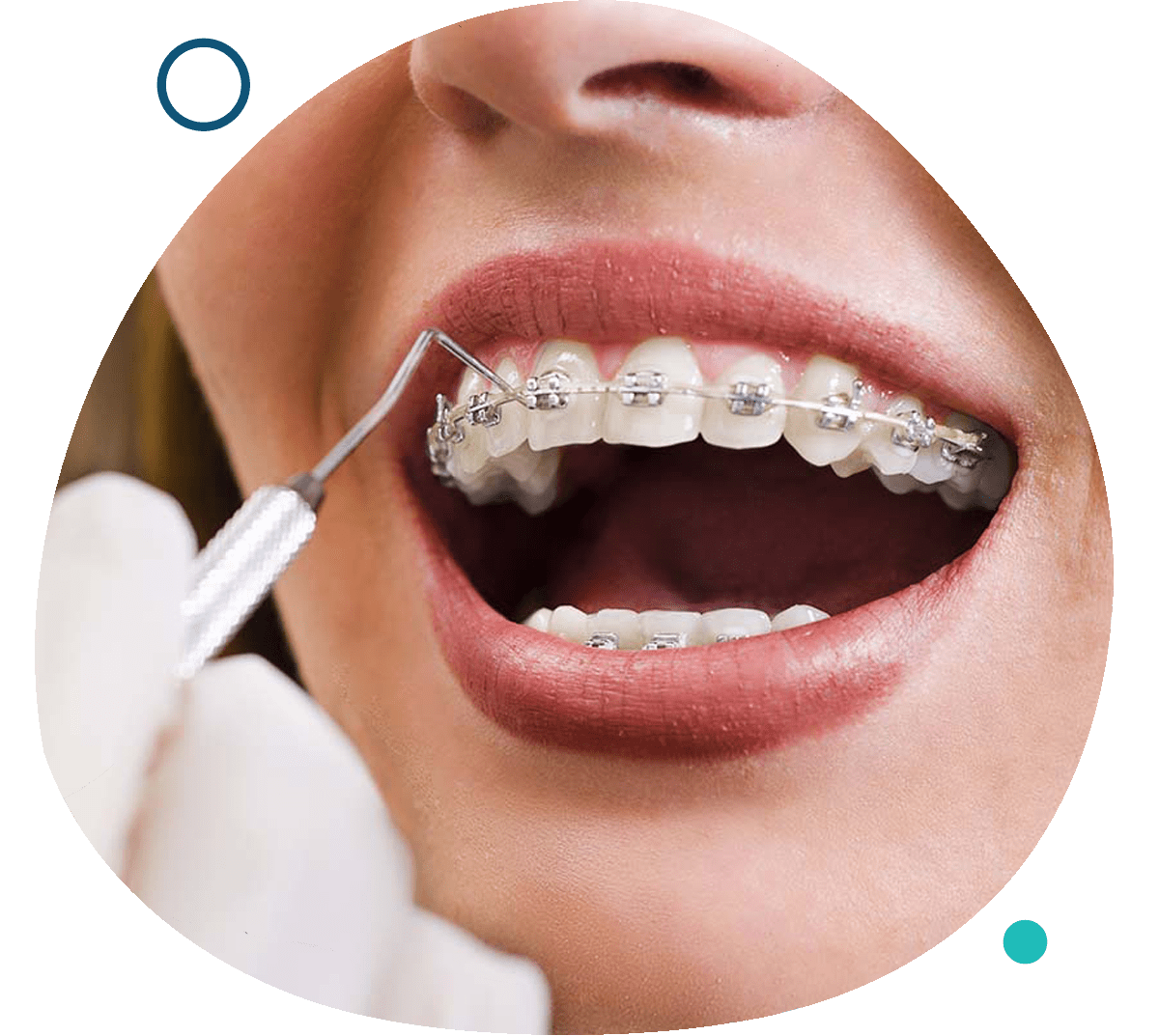 Orthodontics