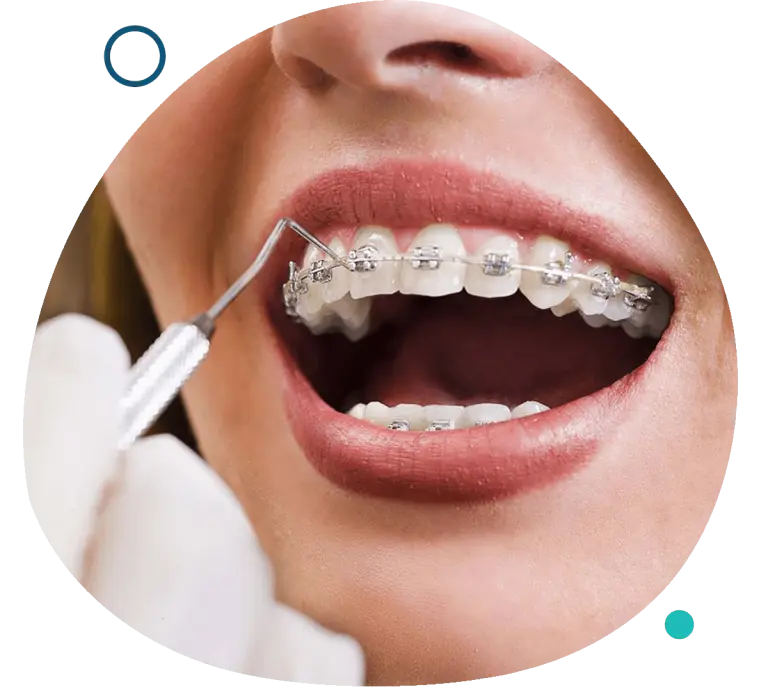 Orthodontics